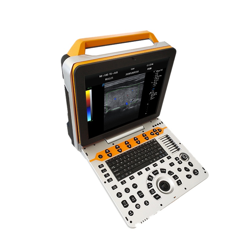 Medical Scanner 4D Ultrasound Scan Machine Portable Color Doppler Ultrasound...