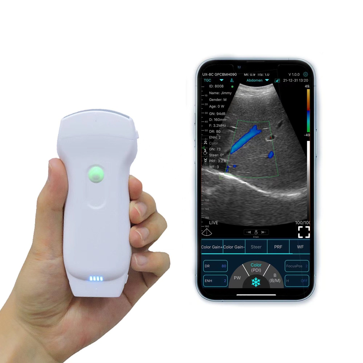 Portable Wireless Ultrasound Machine Ultra small