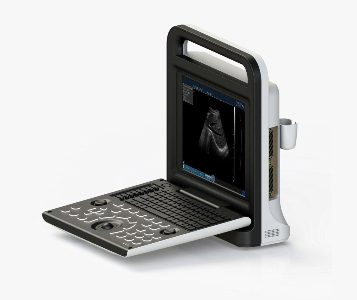 Mobile Full Featured Digital Ultrasound Device