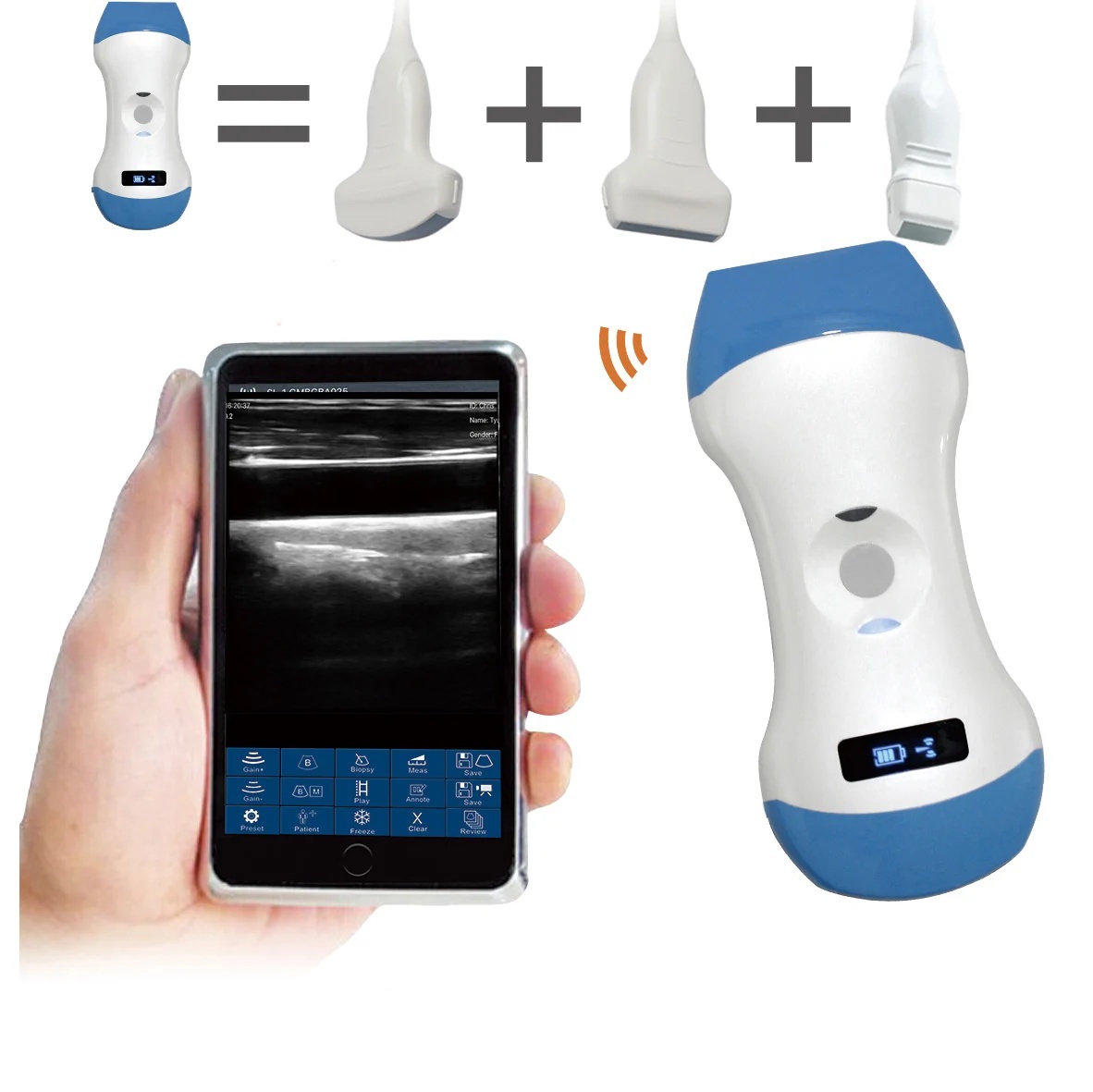 3-in-1 Wireless Ultrasound Scanner Probe Class II Certified Multi-Mode Diagnostic Plastic Electri...