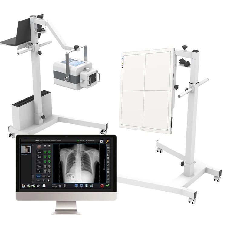 Small Size Xray Digital Iray/DR X Ray Digital Machine Price Light Weight X-ray Machine with Battery