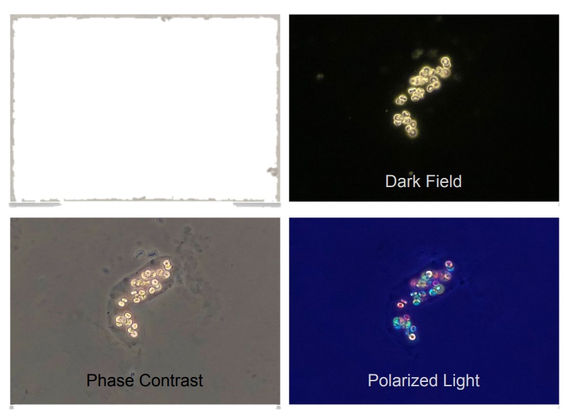 Bright Field Dark Field Phase Contrast Fluorescence Polarized Light Biological Microscope for Vet...