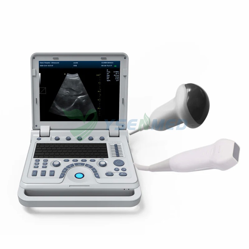 3D Ecografo Ultrasonido Portatil Doppler Medical 4D Ultrasound Machinescanner Portable Color Dopp...