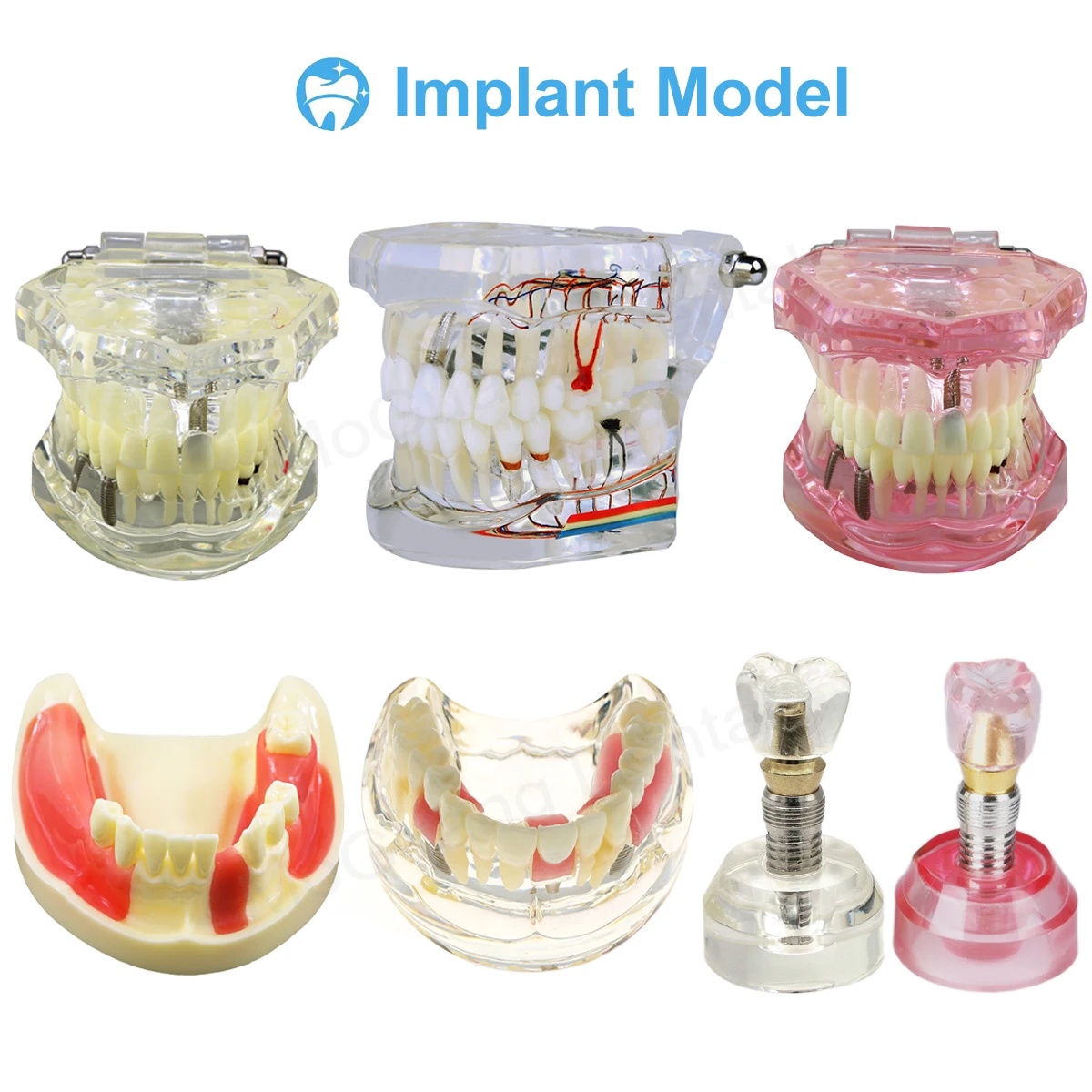 Dental Implant Practice Teeth Model Portable Training Plastic Dental Implant Practice Model