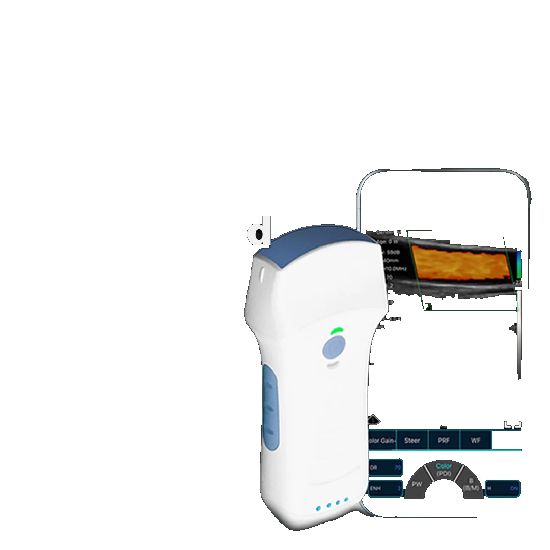 Portable USB WiFi Wireless Double Head Ultrasound Probe